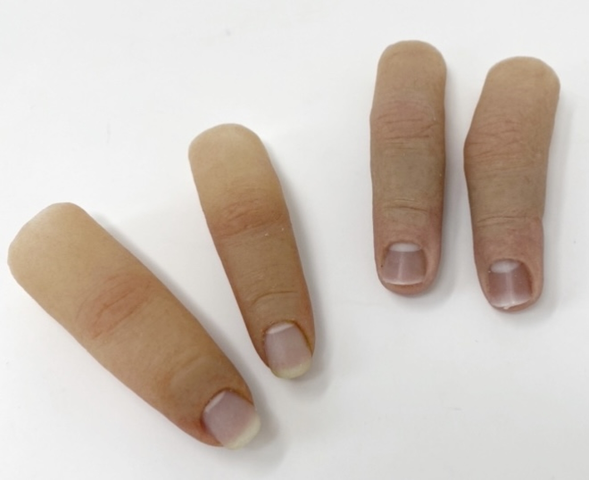 Epítesis parciales de mano y dedo